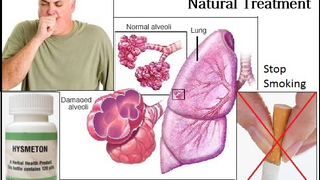 Natural Treatment for Emphysema, Herbs and Natural Essential Oils